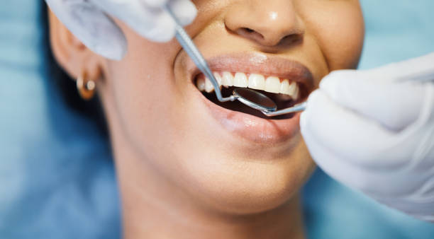 Best Emergency Dental Extractions in Bay Village, OH