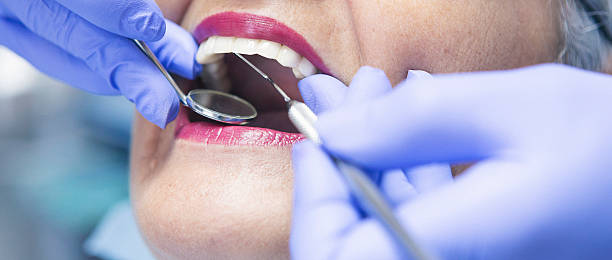 Best Emergency Dentist for Knocked-Out Tooth in Bay Village, OH